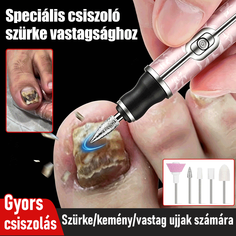 Elektromos körömreszelő onychomycosis kezelésére